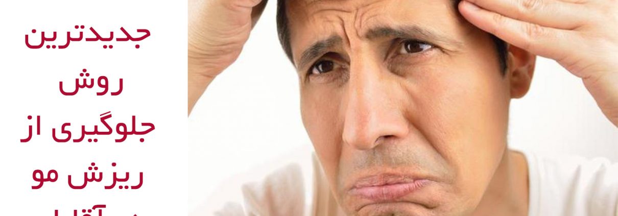 درمان شایع ترین نوع ریزش مو در مردان